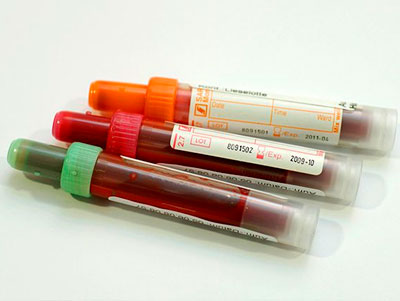 Нетстандартный образец ДНК: Жидкая кровь