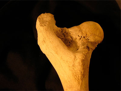 Нетстандартный образец ДНК: Кости (костная ткань)